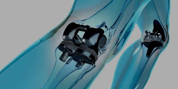 Mexican Medtech: A Well Oiled Machine?