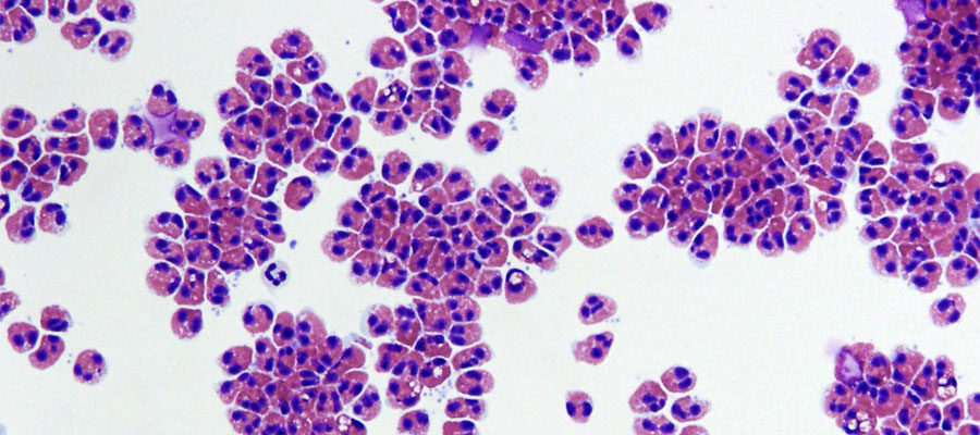 Rethinking Clinical Trials in Rare Diseases