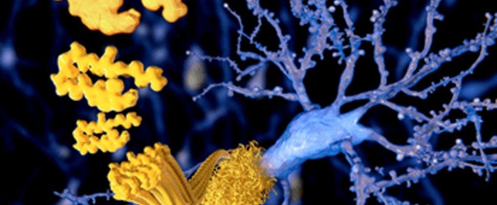 Sweden’s BioArctic: A Potential Paradigm Shift in Alzheimer’s Treatment?