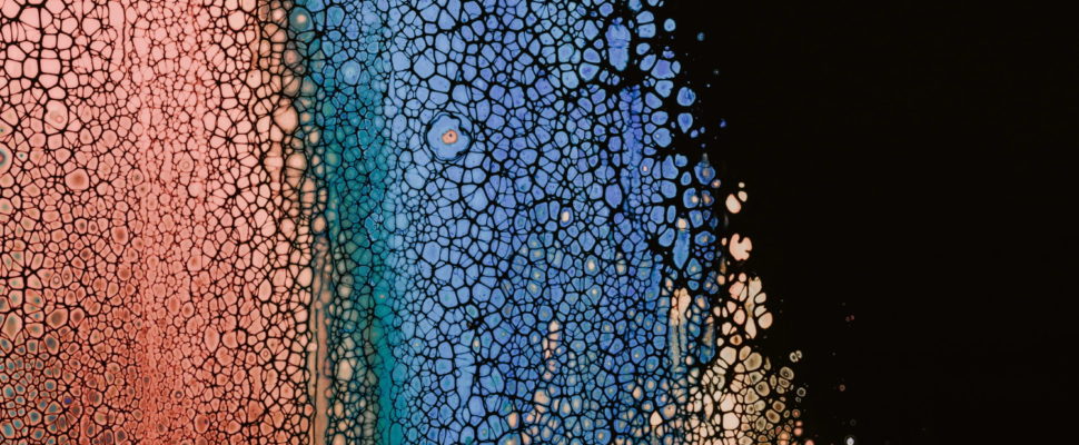 French Cell & Gene Therapy: Finding the Funding