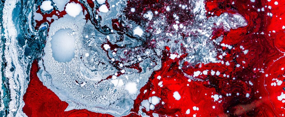 China’s CARsgen Therapeutics Wins US FDA Orphan Drug Designation