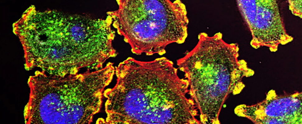 Cell & Gene Therapy Manufacturing: Critical Challenges, Innovative Responses