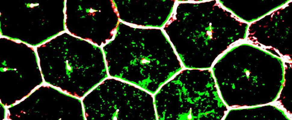 Japan: The Latest Therapeutic Applications in Induced Pluripotent Stem Cell (iPSC) Technology