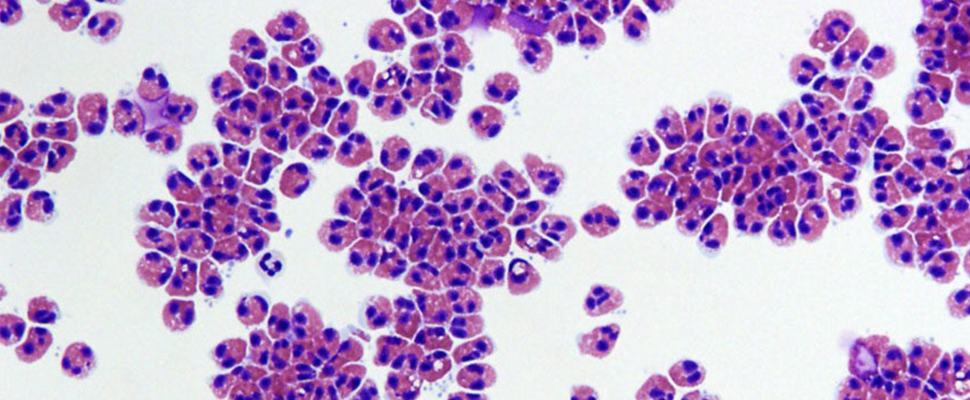 Rethinking Clinical Trials in Rare Diseases