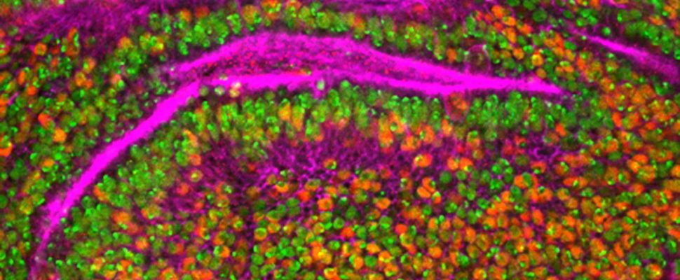Can Europe’s Beating Cancer Plan Make it an Innovation Leader? 
