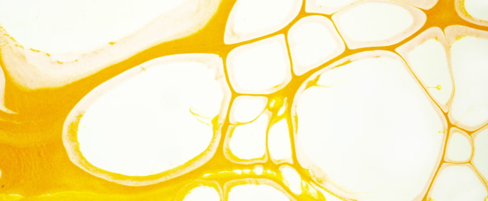 Celltrion: A Korean Biosimilars Pioneer