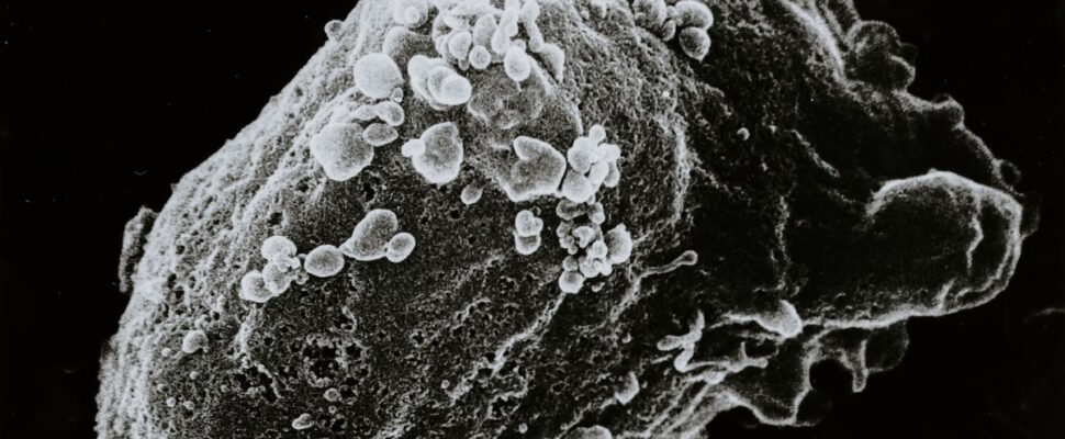 After Four Decades of Battling to Save Lives from HIV/AIDS, Where Are We? (Part Two)