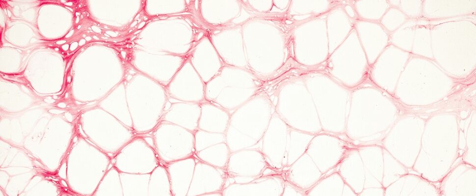 FDA Cell & Gene Therapy Approvals 2024